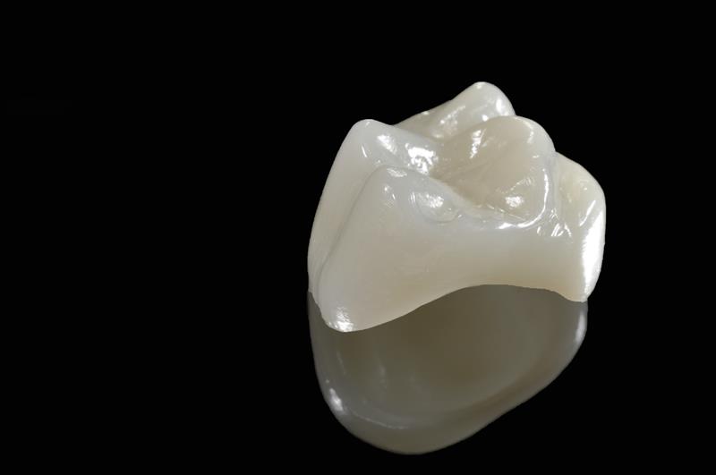 Porcelain Crowns Titusville, FL
