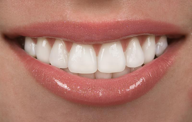 Full Mouth Reconstruction Titusville, FL