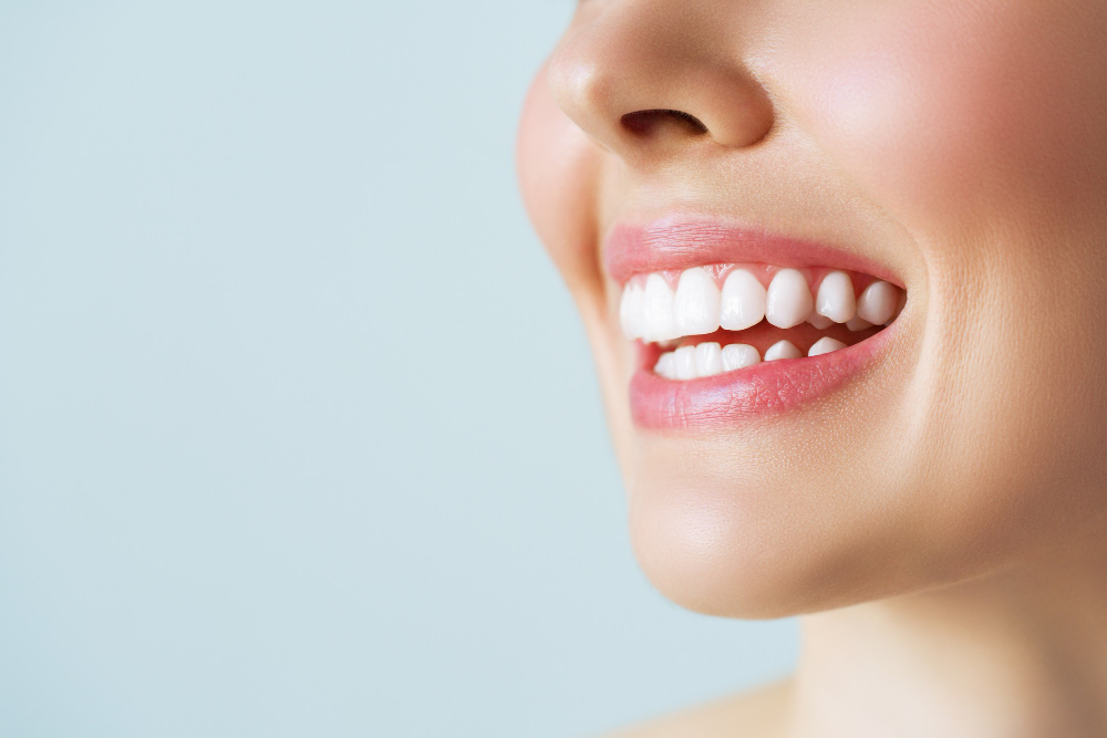 Smile Makeover Titusville, FL